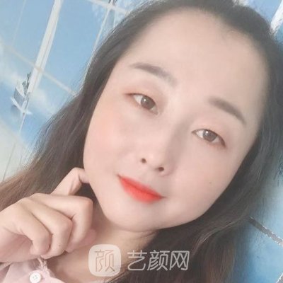 长春伊美整形医院咋样？新版嫩肤除皱实例公开