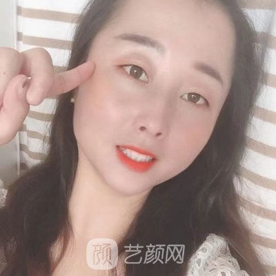 长春伊美整形医院咋样？新版嫩肤除皱实例公开