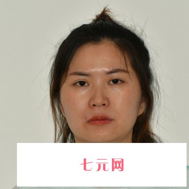 昆明市延安医院杰西艾美容医院除皱实例公开|内附对比图