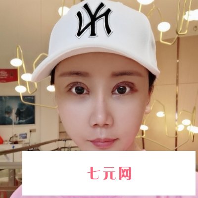 重庆美莱整形医院割双眼皮怎么样?全新体验实例发布