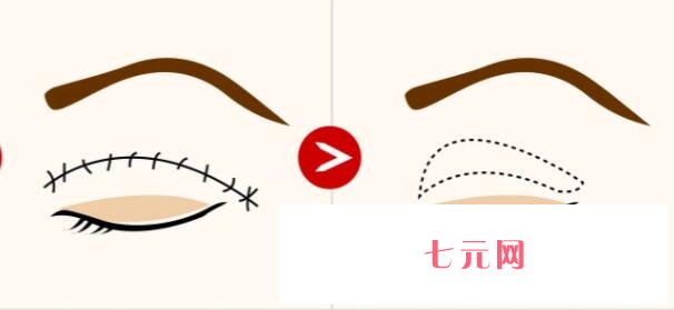 双眼皮动漫44.jpg 双眼皮动漫44.jpg