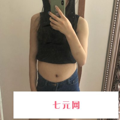 太塬李莉婷医生吸脂技术好吗?全新体验实例公布