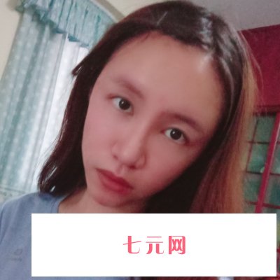 北京美莱整形医院正规吗？全新面部脂肪填充实例公布