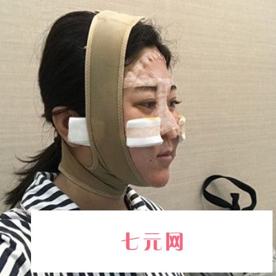 杭州连天美高俊明磨骨怎么样？医生实力及实例展示