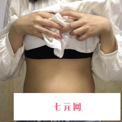 北京美莱董岩岩医生吸脂技术怎么样?招牌体验实例分享