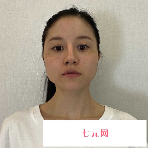 北京张智勇医生磨骨实例曝光|内附体验细节图