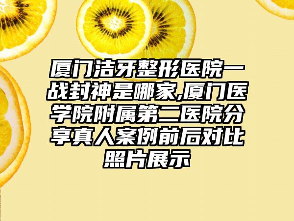 厦门洁牙整形医院一战封神是哪家,厦门医学院附属第二医院分享真人实例前后对比照片展示