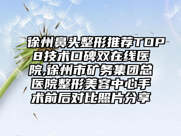 徐州鼻头整形推荐TOP8技术口碑双在线医院,徐州市矿务集团总医院整形美容中心手术前后对比照片分享