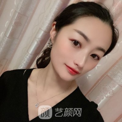 长春中妍整形医院热玛吉除皱实例公开|成果自然美观