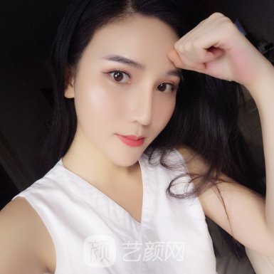 云南华美美莱李韬口碑怎么样?2023面部脂肪填充实例一览