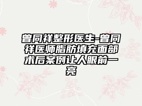 曾同祥整形医生-曾同祥医师脂肪填充面部术后实例让人眼前一亮