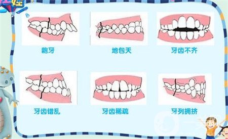 成都铜雀台牙齿矫正可靠么？热门项目、宋婷医生收费介绍一览