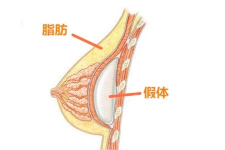 四川娇点姜宇禄隆胸怎样？手术经验多，个人资料、技术口碑在线一览