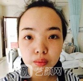 侯振杰外科正牙谁做过？医生详细介绍+正颌实例对比图