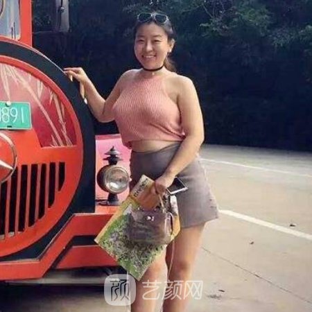 武汉美莱吸脂怎么样?医院实力及实例上线