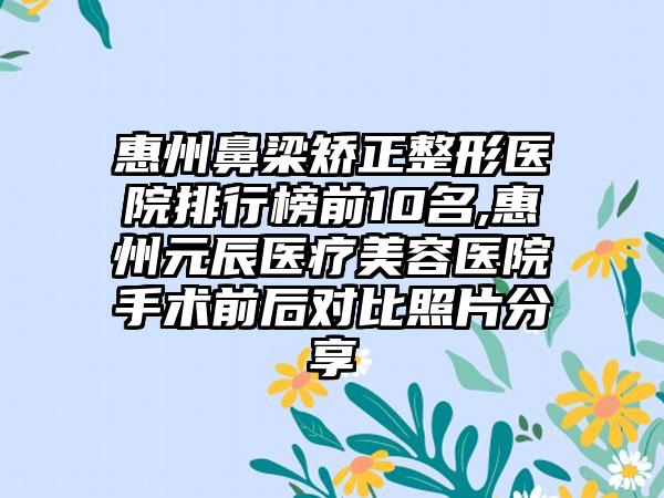 惠州鼻梁矫正整形医院排行榜前10名,惠州元辰医疗美容医院手术前后对比照片分享