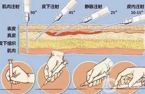 南宁首大疤痕修复医院怎么样？正规吗？坐诊医生介绍、优势攻略一览