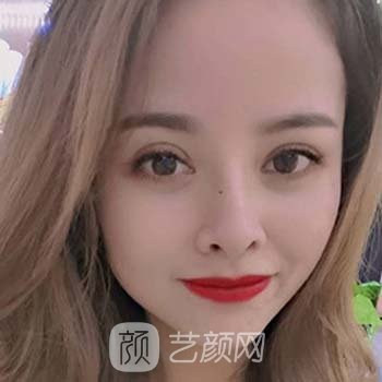 宜昌领美整形医院地址在哪里？正规度如何？双眼皮实例