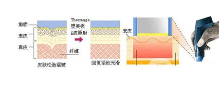 深圳联合丽格整形热玛吉怎么样？正规/技术可靠/收费/医生全有