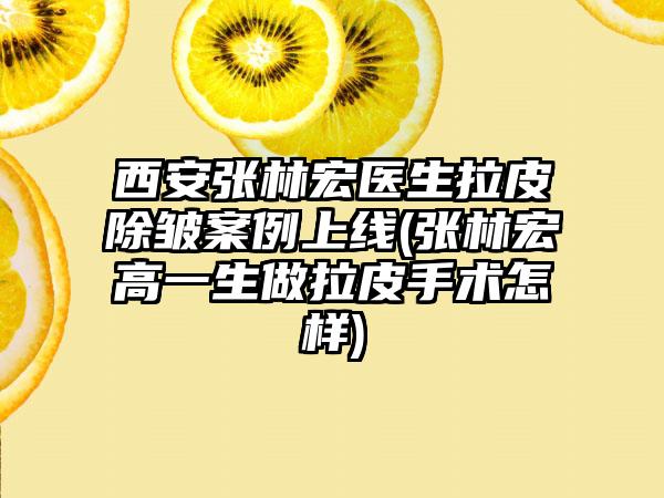 西安张林宏医生拉皮除皱实例上线(张林宏高一生做拉皮手术怎样)