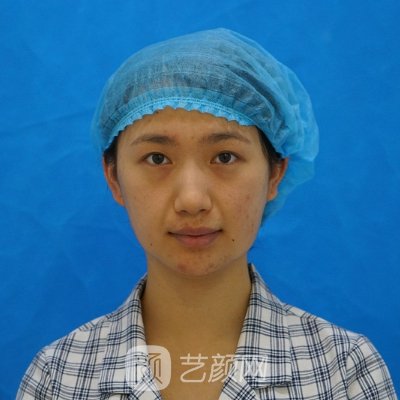 北京金燕子医疗美容诊所除皱抗衰实例展示|内附对比图