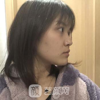 徐州医美整形医院张才有给毁容过吗？no，反而经典实例超多