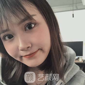 徐州医美整形医院张才有给毁容过吗？no，反而经典实例超多