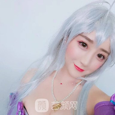 广州臻妍颂整形医院割双眼皮自然吗?90天变化细节一览