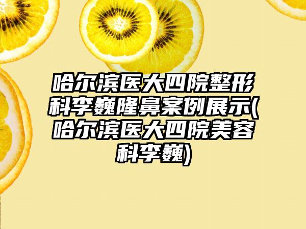 哈尔滨医大四院整形科李巍隆鼻实例展示(哈尔滨医大四院美容科李巍)