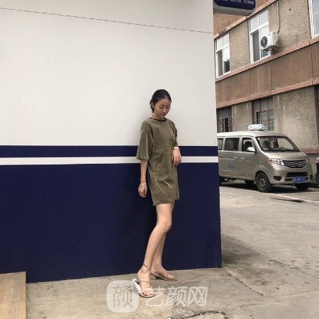 深圳宝丽整形美容医院吸脂实例公布|成果自然美观