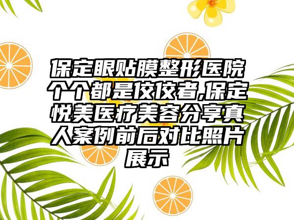 保定眼贴膜整形医院个个都是佼佼者,保定悦美医疗美容分享真人实例前后对比照片展示