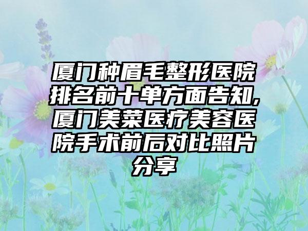 厦门种眉毛整形医院排名前十单方面告知,厦门美菜医疗美容医院手术前后对比照片分享