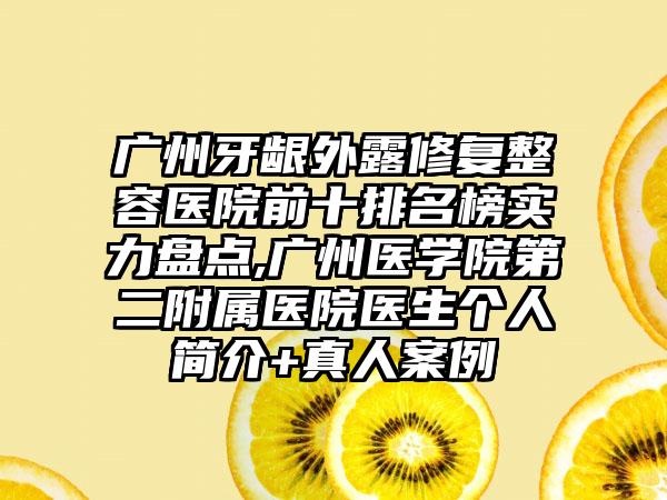 广州牙龈外露修复整容医院前十排名榜实力盘点,广州医学院第二附属医院医生个人简介+真人实例