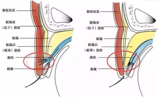 黄冈市中心医院可以做双眼皮吗？多少钱？内有张翰理医生坐诊！