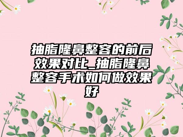 抽脂隆鼻整容的前后成果对比_抽脂隆鼻整容手术如何做成果好