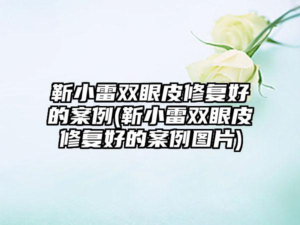 靳小雷双眼皮修复好的实例(靳小雷双眼皮修复好的实例图片)